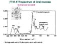 Oral spectrum