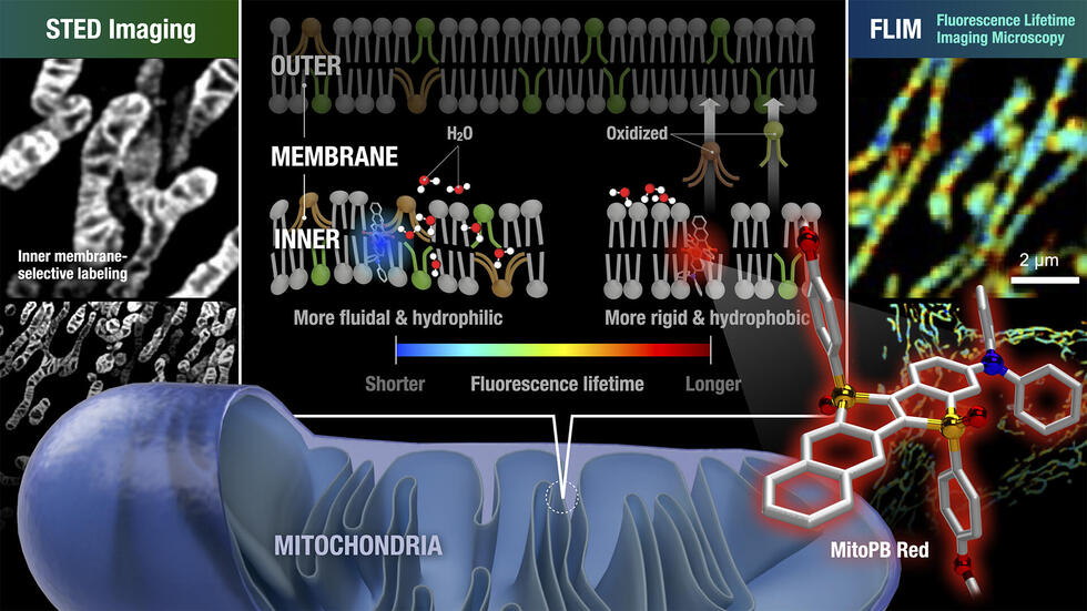 Mitochondria Heterogeneity