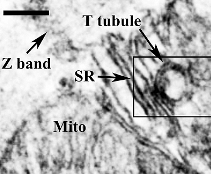 心筋細胞のT管と筋小胞体(SR)の電子顕微鏡像。Bar=200nm